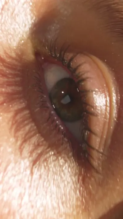 Into the Eye